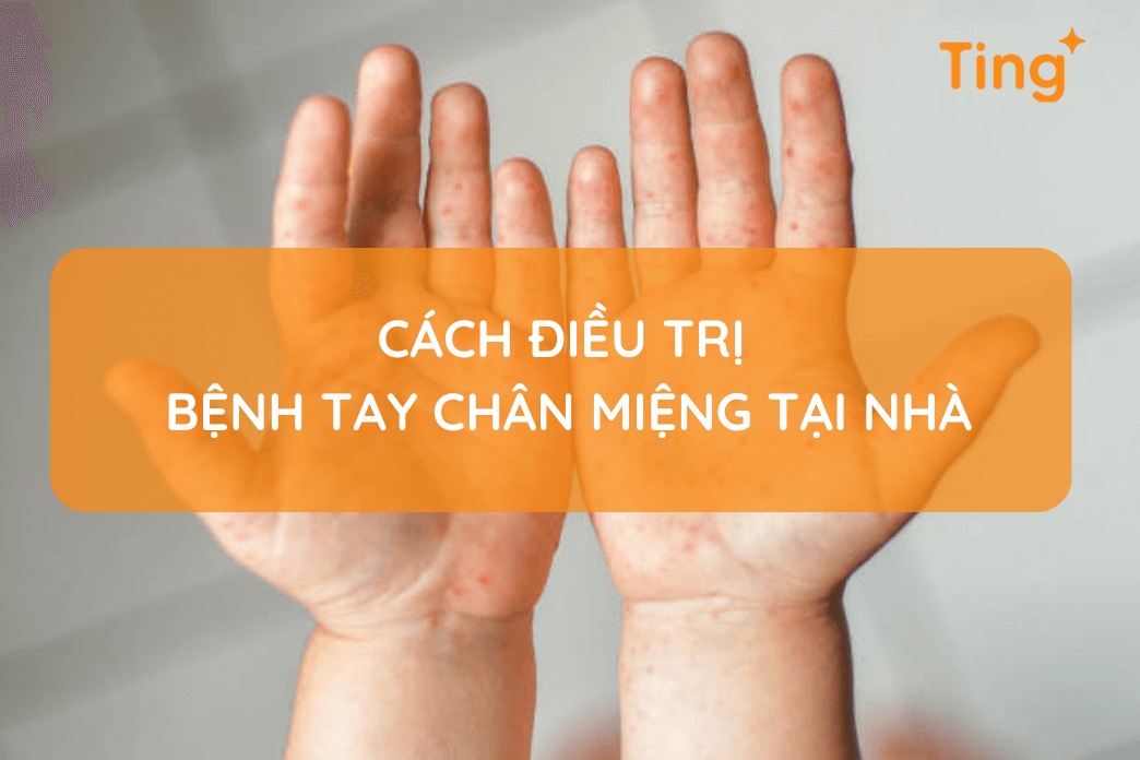 Cách điều trị bệnh tay chân miệng tại nhà